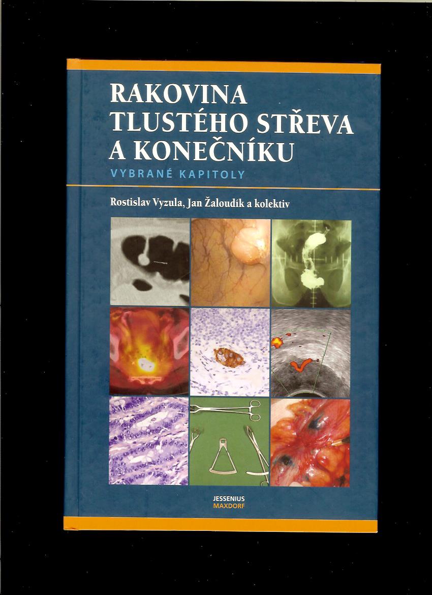 R. Vyzula, J. Žaloudík: Rakovina tlustého střeva a konečníku