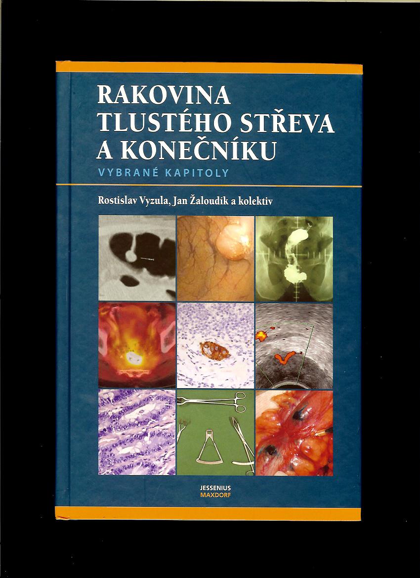 Rostislav Vyzula, Jan Žaloudík a kol.: Rakovina tlustého střeva a konečníku