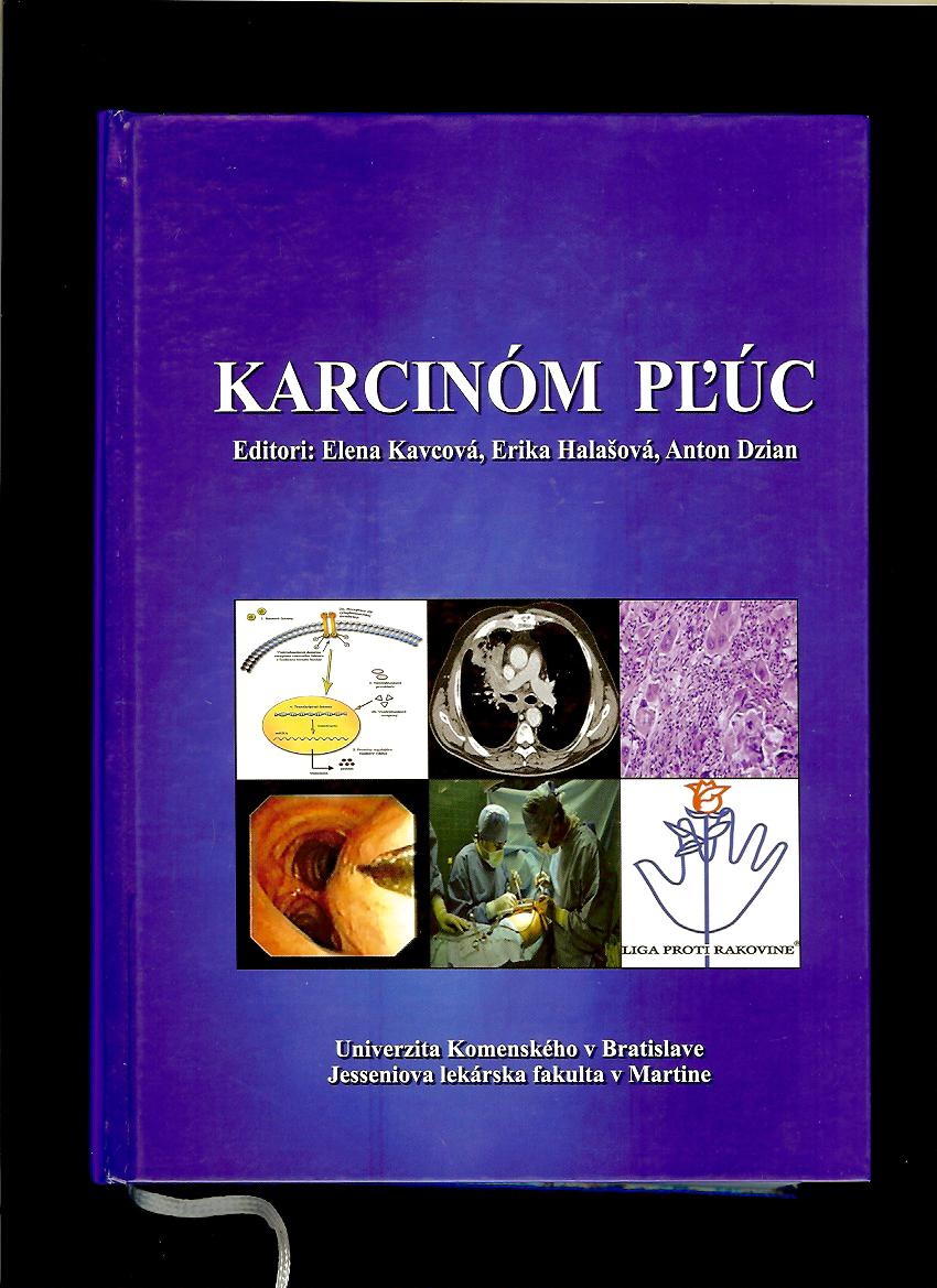 Kol.: Karcinóm pľúc