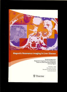 Thomas J. Vogl a kol.: Magnetic Resonance Imaging in Liver Disease